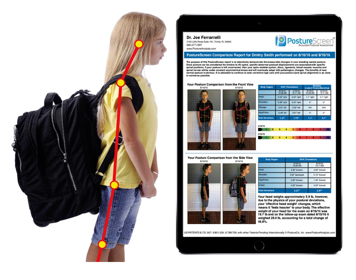 BACK TO SCHOOL POSTURE ASSESSMENT